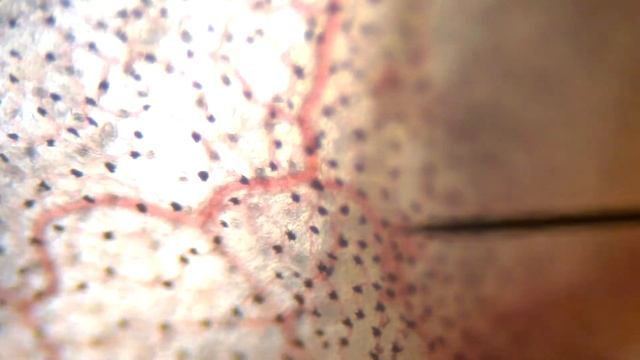 Blood Circulation (frog) - микроциркуляция в плавательной перепонке пьяной лягушки
