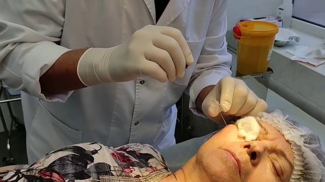 Внутрикостная блокада при невралгии тройничного нерва, выполняет профессор Соков Евгений Леонидович