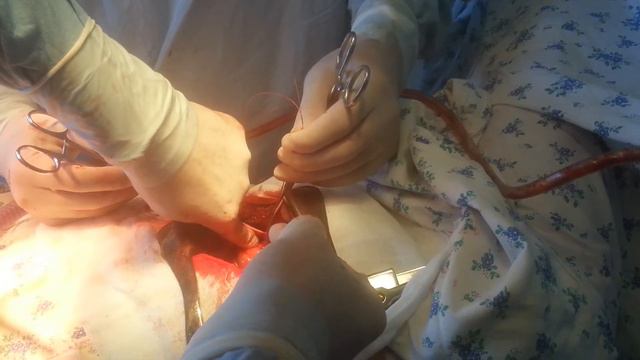 Ушивание ранения сердца (Suturing The Wound Of The Heart) № 1