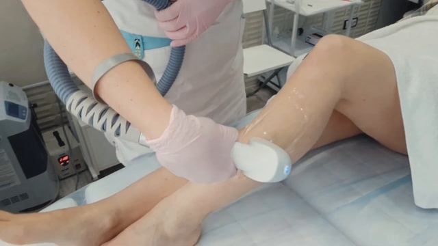 Лазерная эпиляция в Воронеже