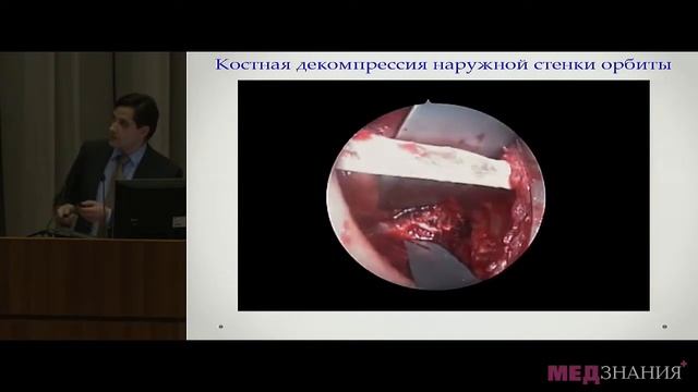 17) Я.О.Груша