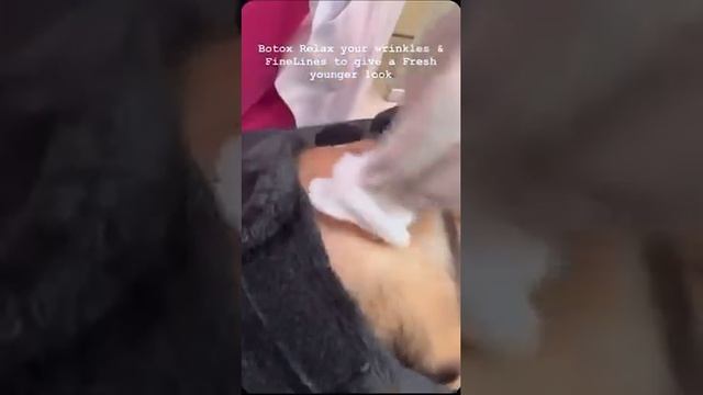 Botox Injection Before And After L Botox Brow Lift L Botox Treatment For Face L Botox Hair Treatmen