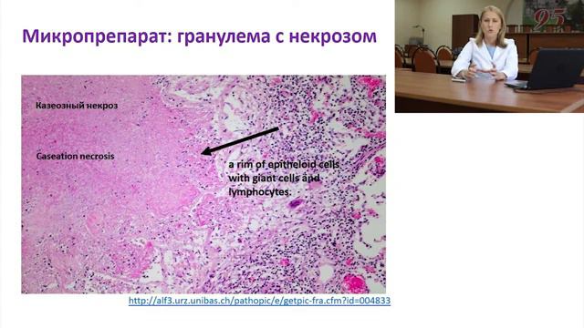 D386dea11ff12ca99a4af4dfb391dd4c