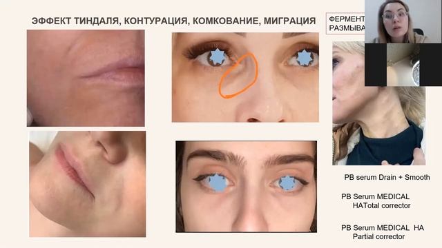 8ff7cd2a078d3c8ad4a025f2be1db857