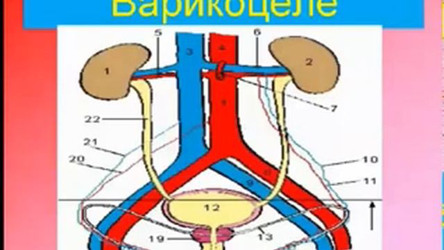 Как избавиться от варикозной болезни Эндорфинотерапия
