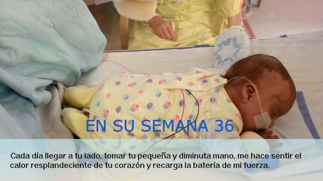 Evolución De  Un Bebe Prematuro  / EDAD CORREGIDA