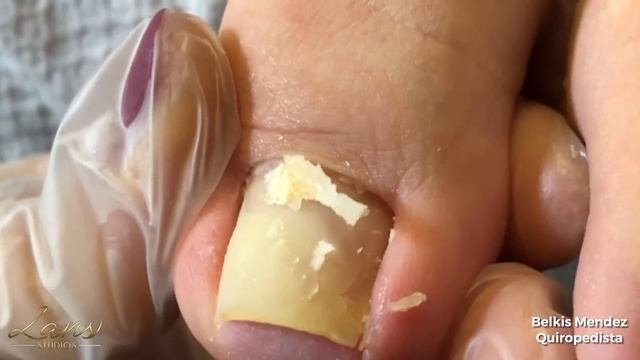 Pedicura Profunda LANSSTUDIOS