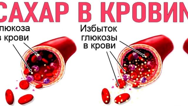 ВОТ что будет если есть ГРЕЧКУ каждый день (ШОК эффект)