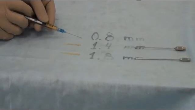 Липофилинг- контурная пластика жиром. Канюли