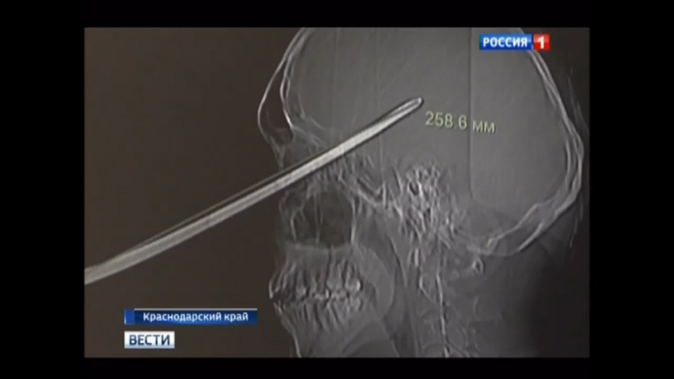 Уникальная операция