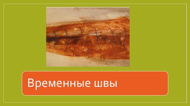 Периоперативная техника