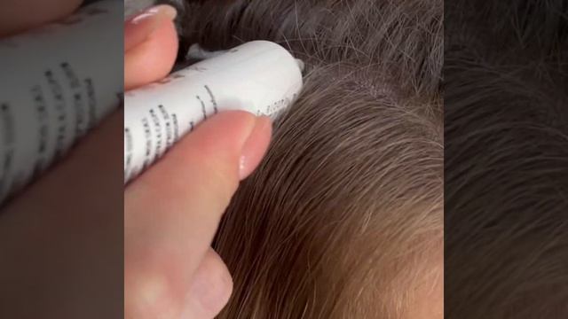 Пілінг шкіри голови