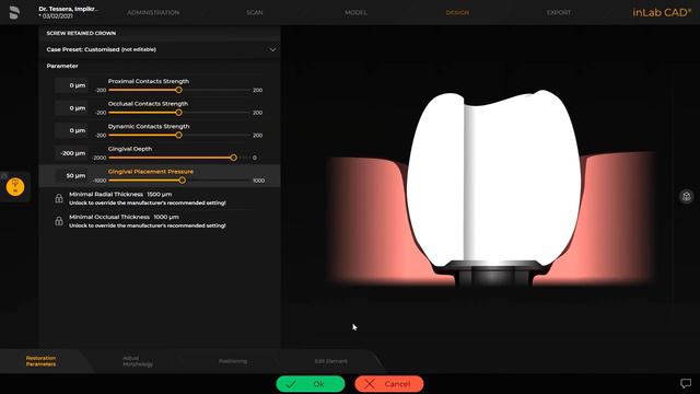 CEREC Tessera™ Abutment Block Design And Processing InLab