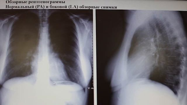 Ec93a8fd3b94c370c8ccce14b02c85dd