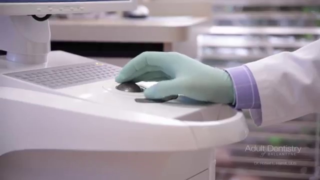 Dental Implants In Charlotte NC - Olga's Story