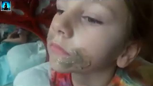Childhood Impetigo   How To Heal It Fast Naturally And Prevent It  Gritheart 254 Kids