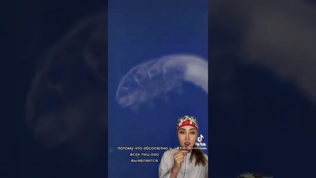 Если тебе поставили Демодекоз #shortsvideo #shortvideo #кожалица#лицевойклещ