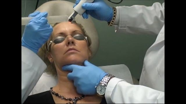 PIXELCO2, Láser De CO2 De última Generación De Alma Lasers