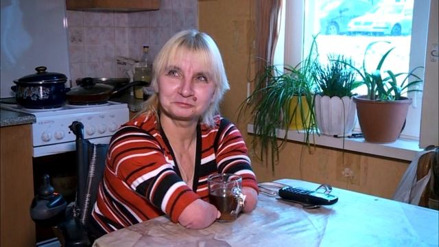 Врач мне сказал делаем аборт: история девочки родившейся без рук и ног!