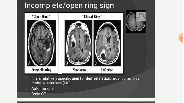 |CT Radiological Signs| Brain,kidneys,lungs,liver,GIT|