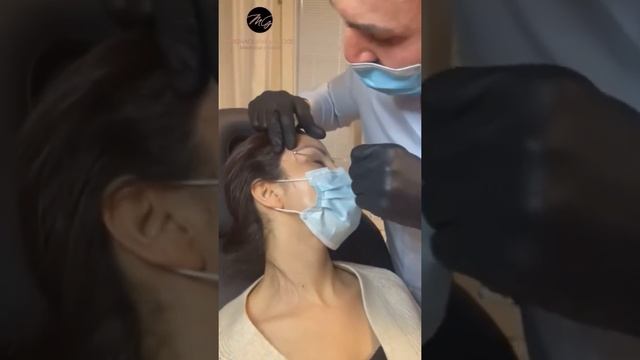 Cat Eye Lift By DoctorGroos ?