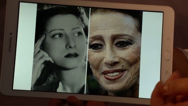 Сохранить молодость! Четыре типа возрастных изменений.