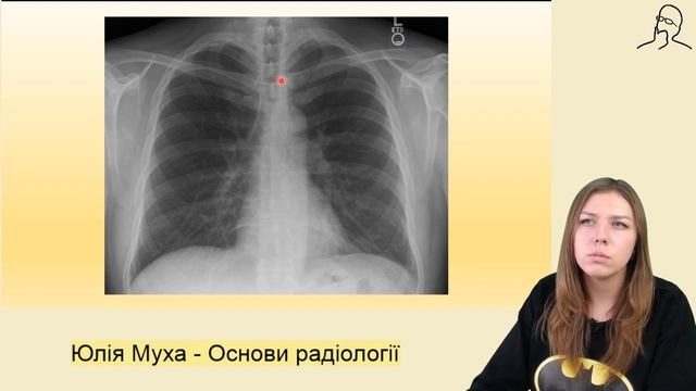 Основи радіології (Діагностика яку ви проспали в університеті)