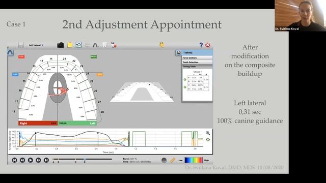 Вебинар: Нарушения ВНЧС и цифровой анализ окклюзии (на русском языке)
