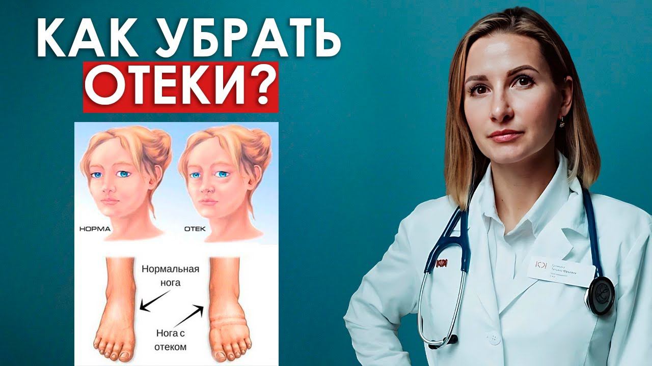 Как избавиться от отеков? Почему появляются отеки?