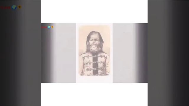 Afsonaviy Bemorlik - Likantroriya 🌻