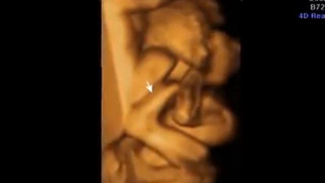 Lorenzo Grey's Ultrasound