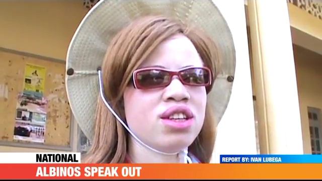 #PMLive: ALBINOS SPEAK OUT