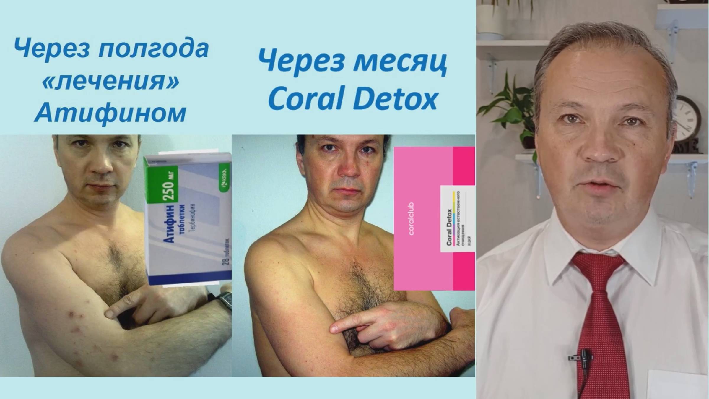 Консультация Печень