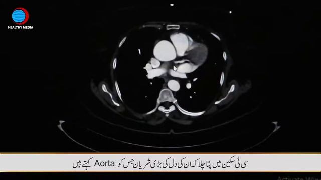 Shifa International Hospital, Asghar Nawaz Cardiothoracic Surgeon Performs A Complex Heart Operatio