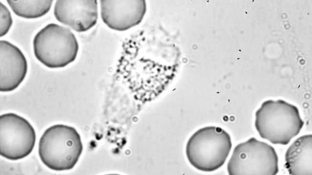 Normal Binocular View 100X Objective With Camera No Lens