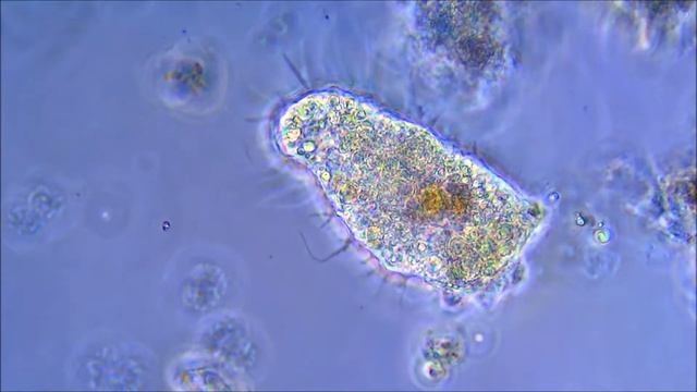 Амёба Мастигамёба (Mastigamoeba Aspera)