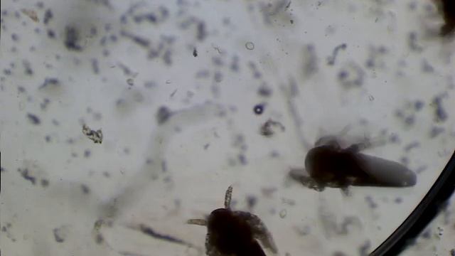 артемии под микроскопом