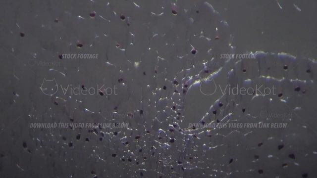 Transversal Section Of Lilium Ovary Magnified By Microscope 100x With Oblique Light