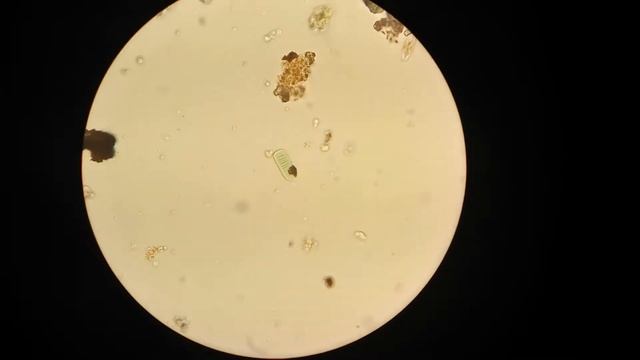 Диатомовая водоросль под микроскопом