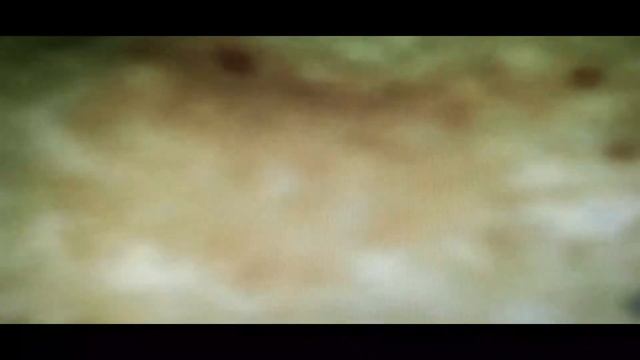 Обзор под микроскопом