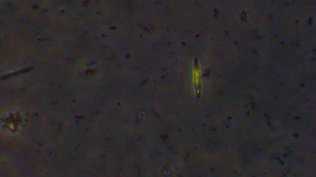 Pond Water Beacon Park Zeiss IM35 X20 Obj Optx1 0 Ph1 090420Video III