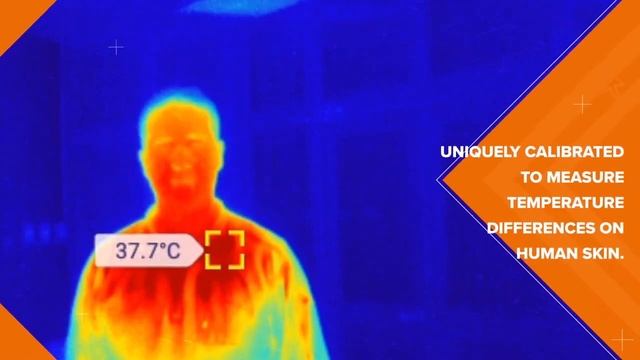 ThermApp MD - Mobile Thermal Imaging Tool For Human Skin Temperature Measurements.