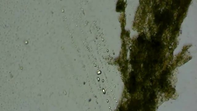 Penampakan Bakteri Pada Selokan Di ZooM 1000 X Di Mikroskop | Edukasi Zoom 1000