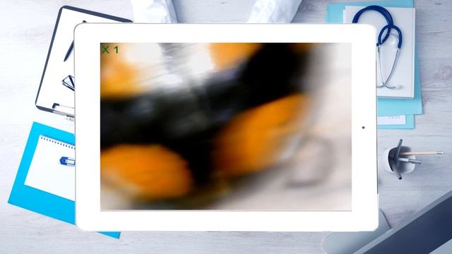 Божья Коровка