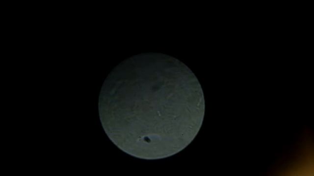 Pond Bacteria At 1000x