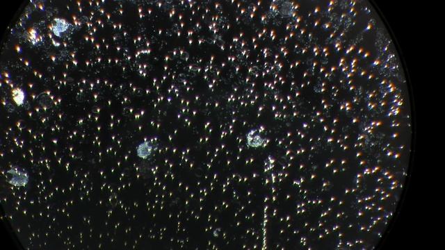 Blood Under Dark Field 3/5-6/17