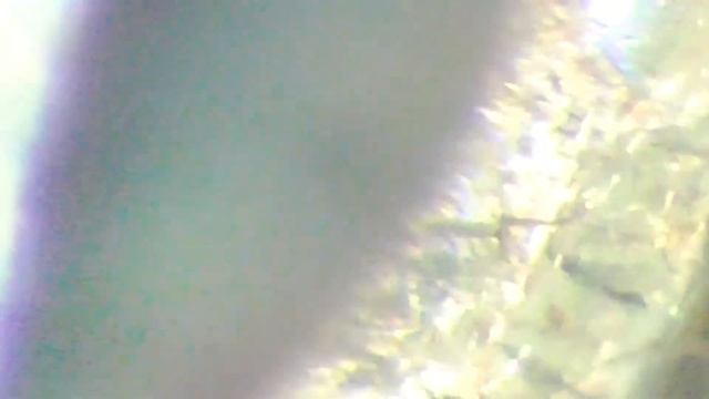 #089 - Morgellons Assimilated Me, Beautiful Colored Head Crusts