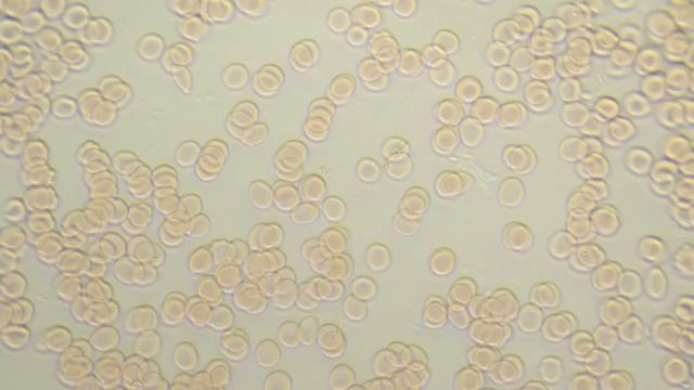 Как КУРКУМА повлияла на тощак на кровь ?