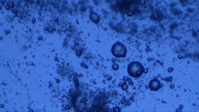 Возбудитель инфекции веревочного червя использует пузырьки воздуха для развития.