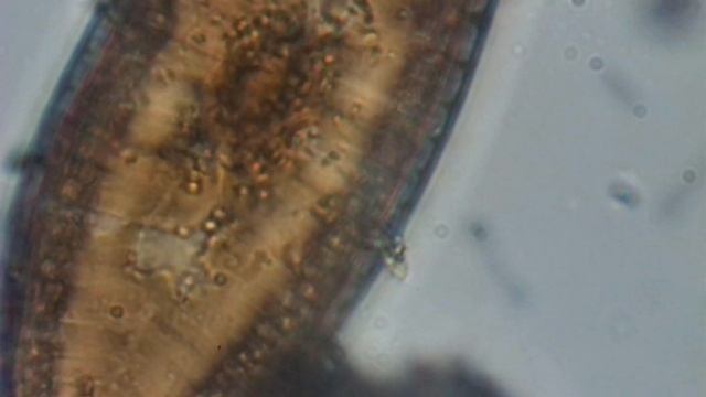 Zoom 400,100x.Wewnątrz Ruch Cytoplazmy.Domowa Mikroskopia.